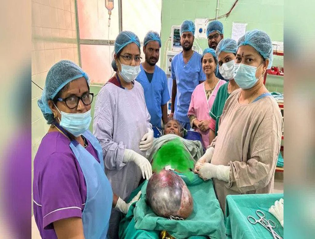 Eight Kg Tumor Removed From Woman's Stomach