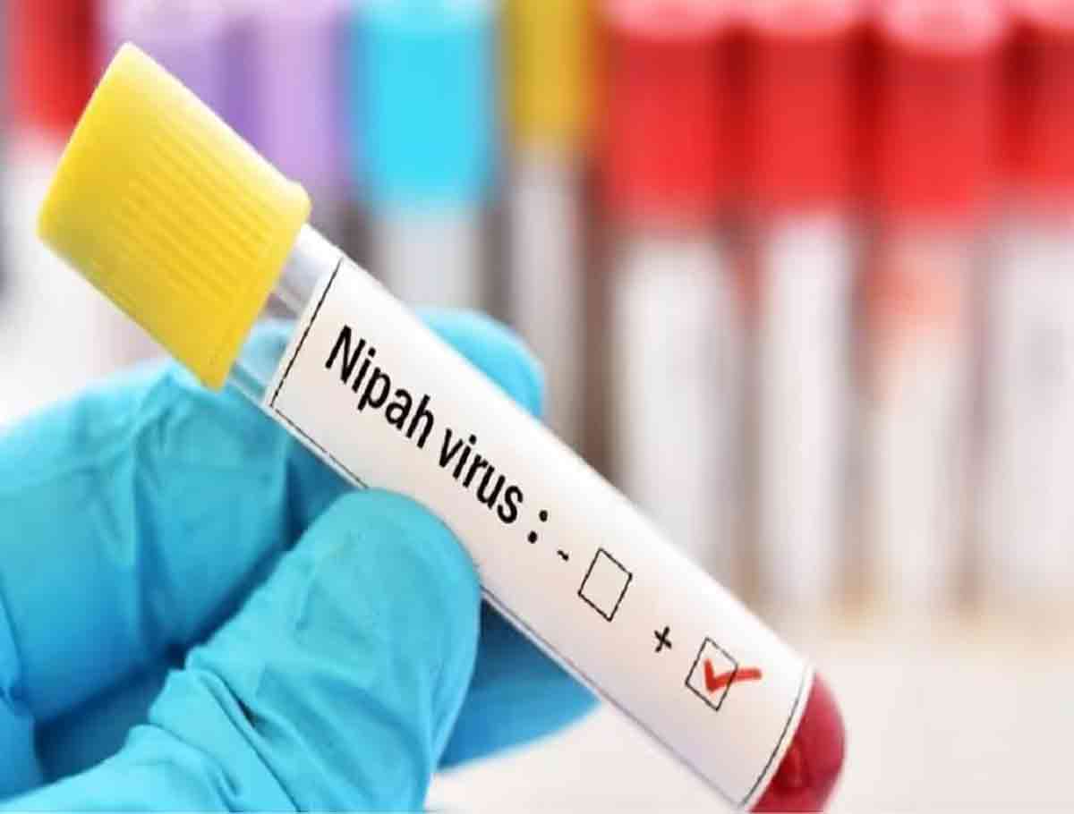 Nipah Virus Kills 14-Year-Old Boy In Kerala